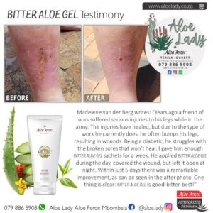 Testimony - Healing Diabetic Sores with Bitter Aloe Gel