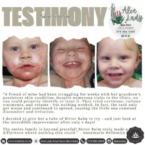 Testimony - Skin reaction