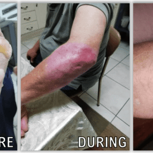 From Injury to Healing: A True Story