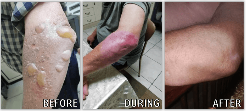 From Injury to Healing: A True Story
